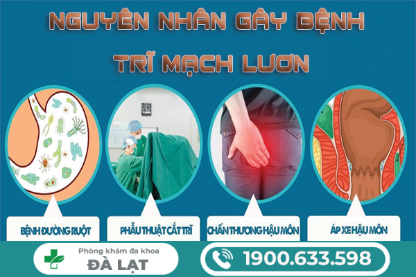 Hình ảnh minh họa